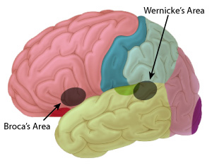 Wernicke's & Broca's aphasia Brain & Language LING 411/412/489